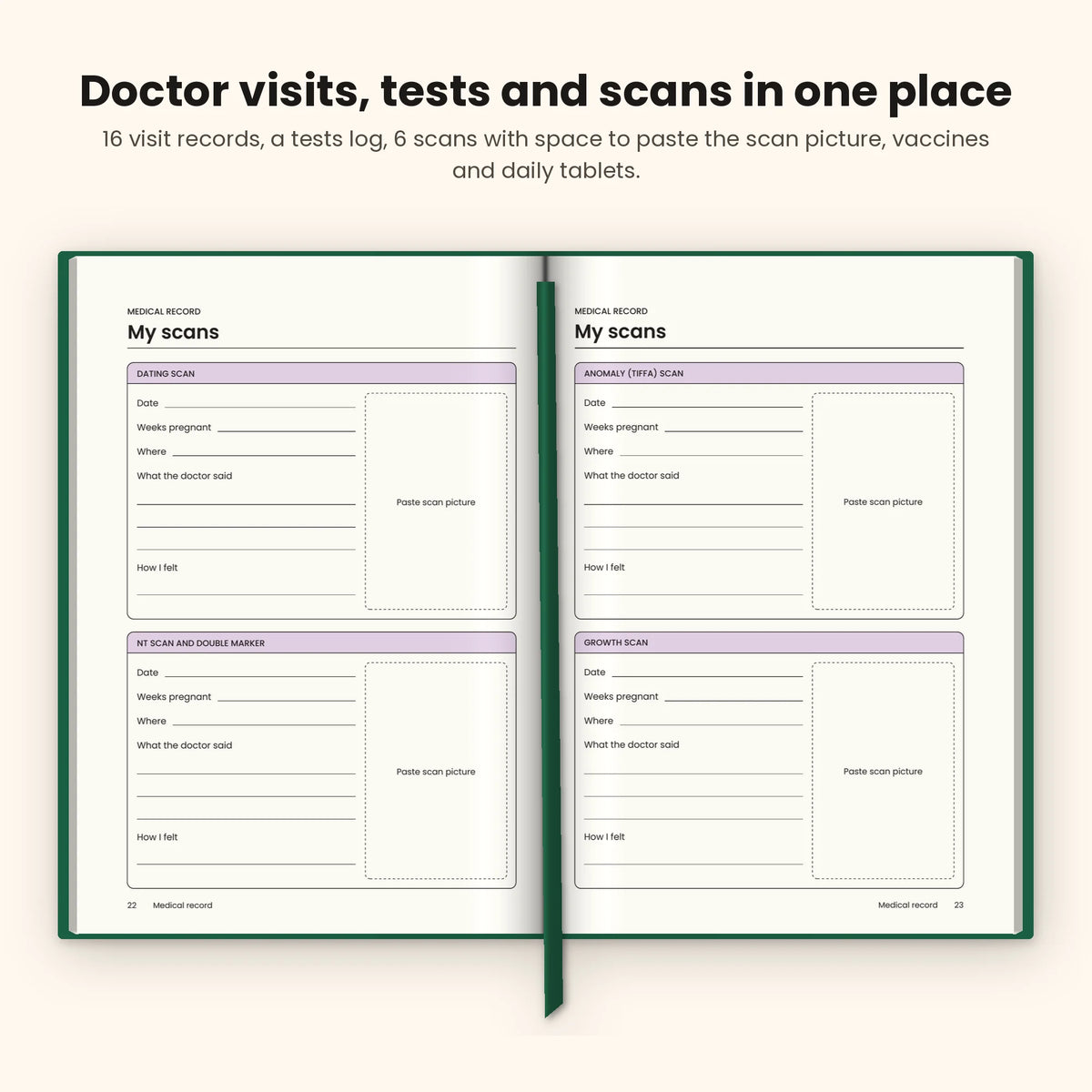 Bottle Green pregnancy journal open at the scan record pages with space for scan pictures