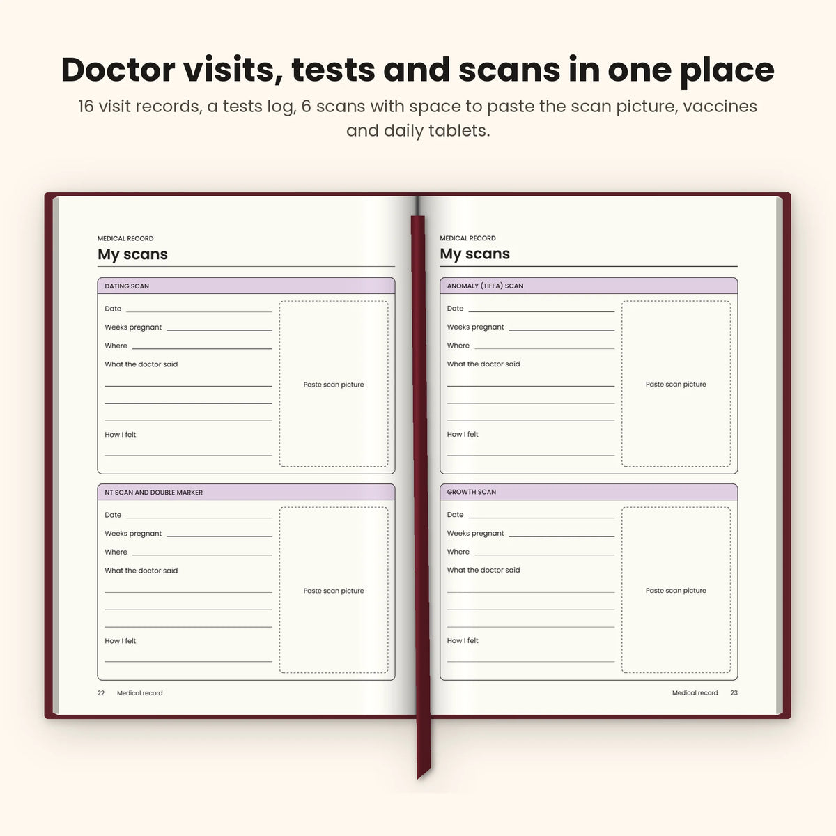 Maroon pregnancy journal open at the scan record pages with space for scan pictures