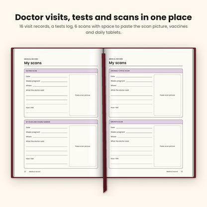 Maroon pregnancy journal open at the scan record pages with space for scan pictures
